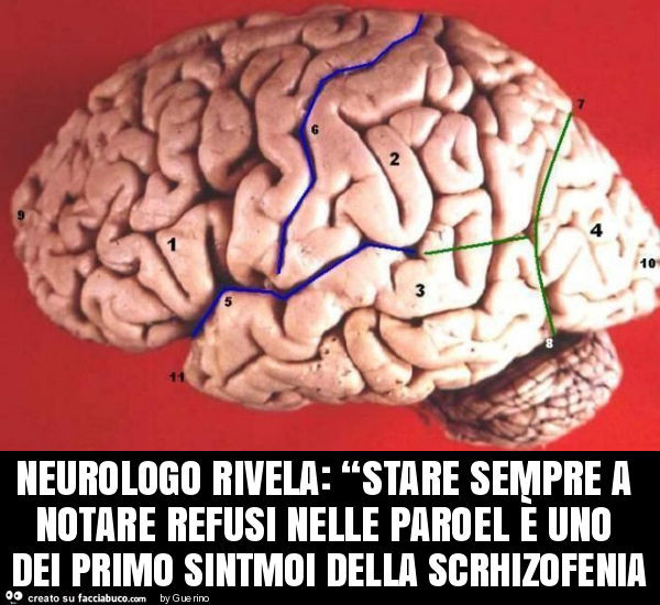 Neurologo rivela: “stare sempre a notare refusi nelle paroel è uno dei primo sintmoi della scrhizofenia