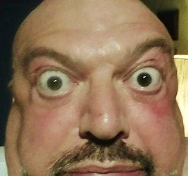 Bulbi leggermente in fuori