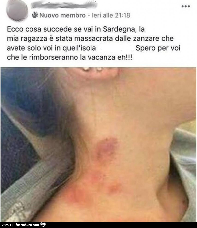 Ecco cosa succede se vai in sardegna, la mia ragazza è stata massacrata dalle zanzare che avete solo voi in quell'isola che le rimborseranno la vacanza eh! Spero per voi