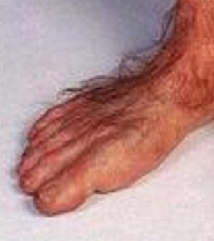 Vaccata